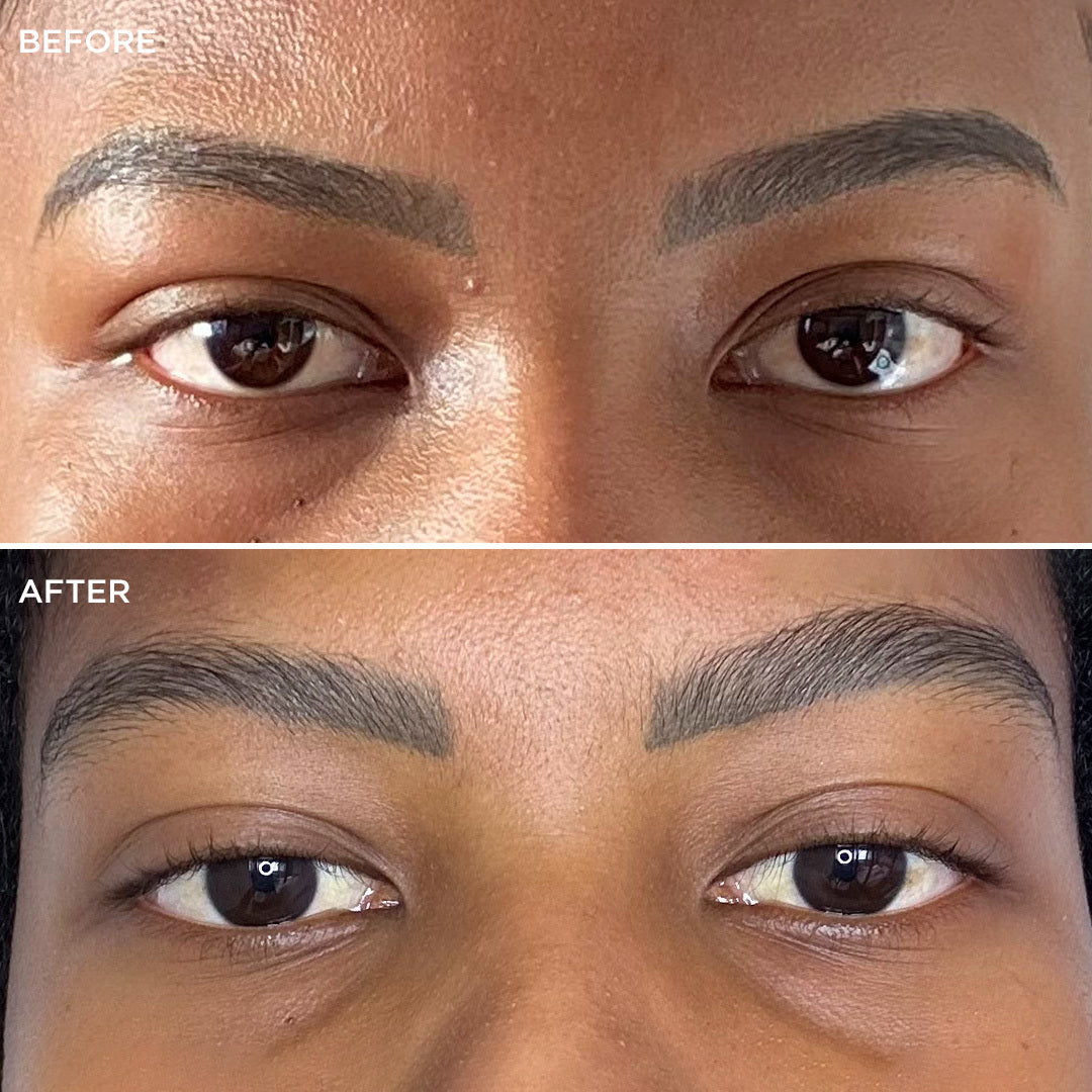 Before and after comparison 4
