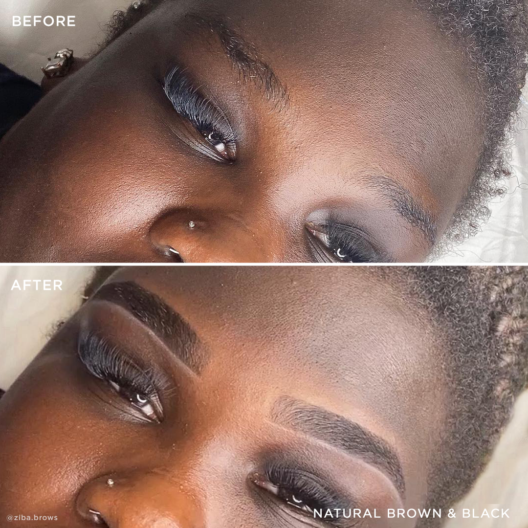 Before and After color-black